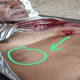 إصابة مواطن برصاص قناص حوثي شمال لحج