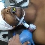 إصابة قيادي حوثي خلال اشتباكات بينية بصفوف المليشيات شمال لحج