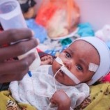اليونيسيف تحذر من تعرض ملايين الأطفال في اليمن لسوء التغذية