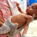 الصحة العالمية :النظام الصحي في اليمن هش ويقترب من الانهيار