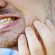 كيف يؤثر التوتر على صحة الأسنان؟