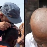 ظاهرة غامضة تتسبب في سقوط شعر جماعي لسكان إحدى ولايات الهند