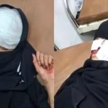 إصابة 3 فتيات في قصف حوثي على حي سكني بتعز اليمنية