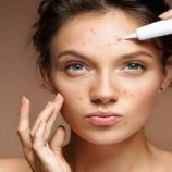 الطفح الجلدي على الوجه.. متى يكون جرس إنذار لأمراض باطنية خفية؟