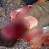 مخلفات الحوثي تصيب فتى بجروح خطيرة في محافظة تعز اليمنية