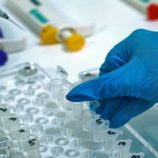 خبير: انتقال فيروسات الميربيكو إلى البشر مسألة وقت