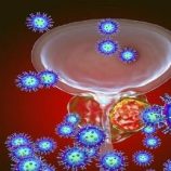 طبيب يفند خرافات شائعة عن ورم البروستاتا الحميد