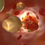 أفضل وجبة فطور لخفض الكوليسترول الضار