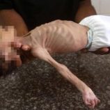 المجاعة تحصد أرواح الأطفال في غزة