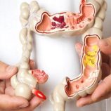 8 أطعمة تقلل خطر الإصابة بسرطان القولون