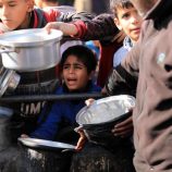 وفاة طفل بسبب سوء التغذية في غزة