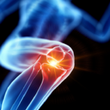 الألياف البلاستيكية الدقيقة وتأثيرها على قوة العظام