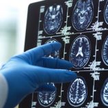 الإمارات تطلق أول تجربة سريرية لتقنية “الذكريات الاصطناعية” لدعم مرضى الزهايمر والخرف