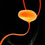 السر وراء إصابة الرجال بسرطان المثانة أكثر من النساء بأربعة أضعاف