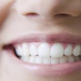 طريقة بسيطة  وعملية لحماية الأسنان من التسوس