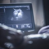 تلوث الهواء يبطئ نمو دماغ الأطفال حديثي الولادة!