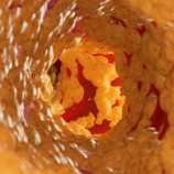 دهون خفية تلحق الضرر بالشرايين حتى لدى النحفاء