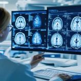 شبكة عصبية روسية تشخص نوع الورم عند الإصابة بسرطان الدماغ