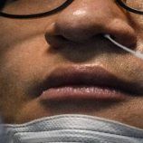 فقدان حاسة الشم من آثار جائحة “كوفيد” طويلة المدى