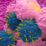 دراسة تحذر: تناول اللحوم المصنعة أسبوعيا يزيد خطر الإصابة بسرطان الثدي