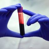 فحص دم جديد يكشف 50 نوعا من السرطان قبل ظهور الأعراض