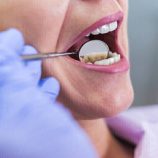 ارتكب 23 جريمة جنسية.. الحكم على صاحب صالون تبييض أسنان في بريطانيا بالسجن 26 عاما