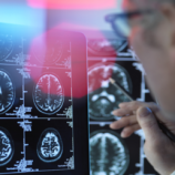 ست علامات تحذيرية في منتصف العمر تنذر بالخرف لاحقا