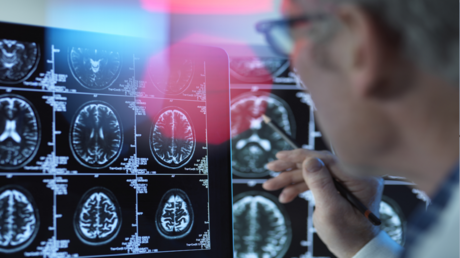 ست علامات تحذيرية في منتصف العمر تنذر بالخرف لاحقا