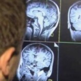 «المواد الكيميائية الدائمة» قد تزيد خطر الإصابة بأمراض مناعية خطيرة