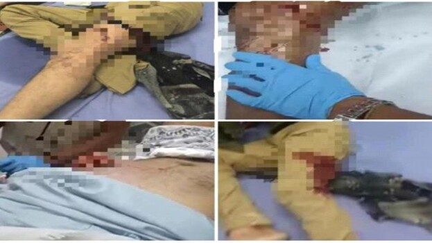 مصادر طبية : ارتفاع ضحايا استهداف المتظاهرين إلى 17 جريحاً