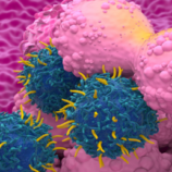 علاج لسرطان الثدي يقي المريضات من أثر جانبي مرهق ومثير للقلق