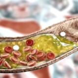 تعرف على أطعمة تخفض الكوليسترول خلال أسابيع